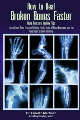 #ad How to Heal Broken Bones Faster. Bone Fracture Healing Tips: Learn About Bone F $13.99