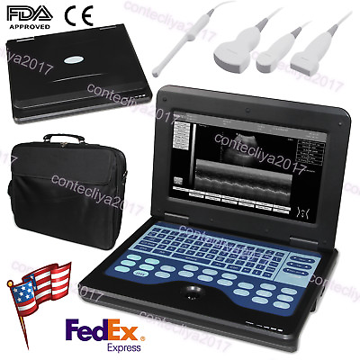 #ad FDA CE 10.1 Inch Portable Ultrasound Scanner Laptop Machine CMS600P2 For Human $1749.00