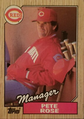 #ad 1987 Topps #393 Pete Rose Manager Rare Error Card Free Shipping $3000.00