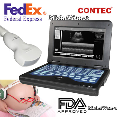 #ad Ultrasound Scanner Laptop Digital Abdominal Diagnostic Machine 3.5 Convex USA $1249.00