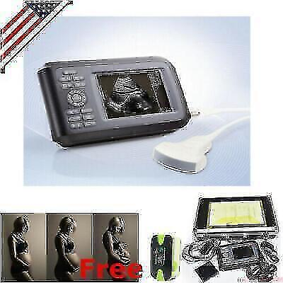 #ad Portable Color Convex Probe Ultrasound Scanner Compact Abdominal Imaging $1019.00
