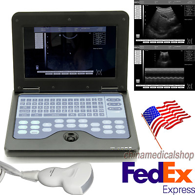 #ad Portable Laptop Machine Digital Ultrasound Scanner Convex Abdominal Probe CEamp;FDA $1249.00