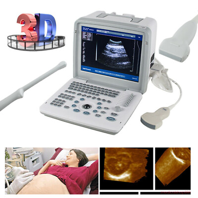 #ad 3D Full Digital Ultrasound Scanner Machine Convex Linear Transvaginal Probe $400.00