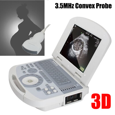 #ad Portable Laptop Full Digital Ultrasound Scanner Convex probe 3D Software New $1350.00
